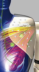 Targeted Muscle Reinnervation Chicago